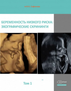 Беременность низкого риска: эхографические скрининги. Том 1 - И.Н.Сафонова