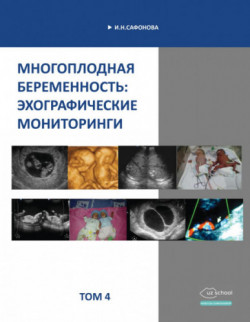 Многоплодная беременность: эхографические мониторинги. Том 4. - И.Н.Сафонова.